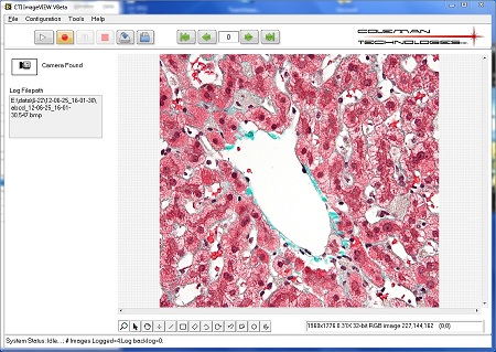 imageview-main-window-liver-sample-2